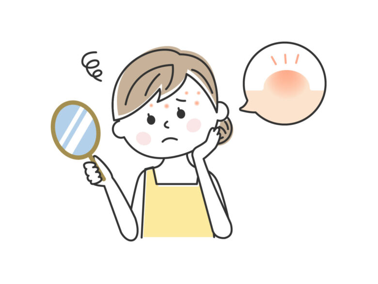 皮膚科で治らないニキビの本当の原因とは？根本改善のためのアプローチ
